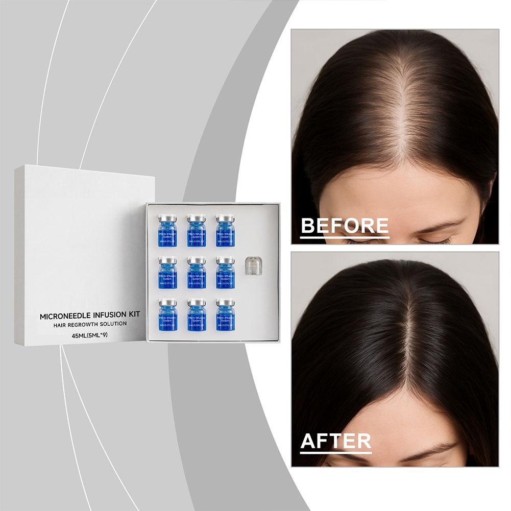 Hair Care Conditioner - 0.25 ミリメートルヘアエッセンシャルセラムマイクロニードルローラーセット毛包栄養頭皮ヘアケア髪を厚くするコンディショナーエッセンス