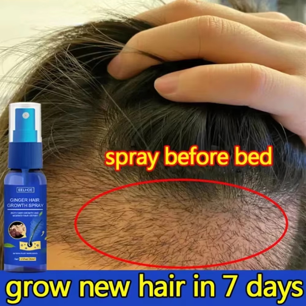 Hair Care For Hair Loss - 速効性ジンジャーヘアグローススプレー、毛根育成、脱毛防止、育毛セラム、頭皮ダメージ修復、栄養ケア製品、女性男性用