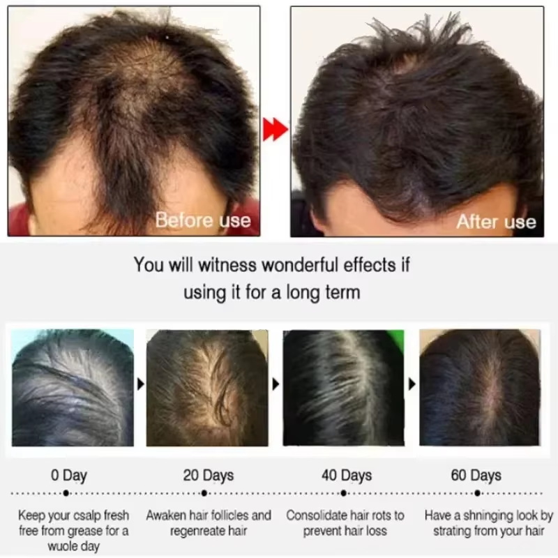 育毛血清 7 日間高速再生エッセンシャルカプセル抗脱毛ハゲ修 - Hair Care Capsule のレビューと価格