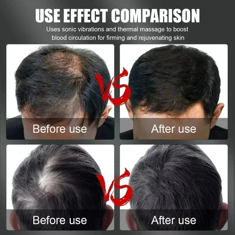 660nm 850nm赤色光赤外線ヘアセラピー育毛キャップ脱 - Hair Care For Hair Loss のレビューと価格